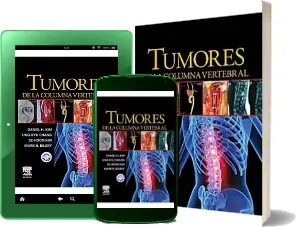 Descarga Tumores de la Columna Vertebral + cd- Rom móvil|celular|tablet + eBook