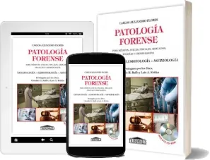 Google Books en PDF: Patología Forense de Carlos Alejandro Flores en Español 2022 | Kindle - iPad versión completa