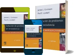 Descargar «Solucion de Problemas en Endodoncia. Prevencion, Identificacion y Tratamiento, 5ta. Ed.» en PDF gratis | James Gutmann | 2022 + ePub