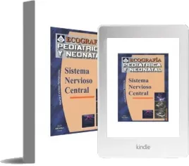 Ecografia Pediatrica Neonatal Del Sistema Nervioso Central Resumen PDF para descarga | María Cristina Sperperato