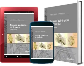 [DESCARGA] «Tecnicas Quirurgicas en Urologia. Clinica Cleveland» PDF gratis 2022 + eBook