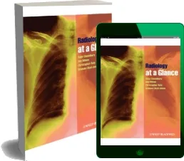Radiology at a Glance review + descarga directa PDF + eBook