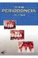 PDF Atlas de Periodoncia del autor Enrico g. Bartolucci