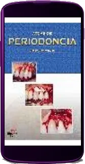 Atlas de Periodoncia de Enrico g. Bartolucci completo en DOCX, DOC, PDF, EPUB, TXT, WORD, PPTX, PDB Colección Odontología