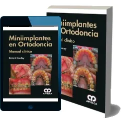 Google Drive gratis en PDF: Miniimplantes en Ortodoncia. Manual Clinico de R. Cousley 2022 