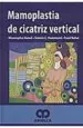 PDF Mamoplastia de Cicatriz Vertical del autor M. Handi