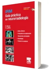Descargar Irm. Guia Practica en Neurorradiologia | Heran Lafitte » PDF + ePub