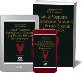 Atlas de Variantes Radiologicas Normales Que Pueden Simular Enfermedades Para descargar por MEGA