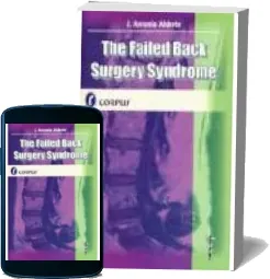 Descargar The Failed Back Surgery sindrome PDF y eBook 2022