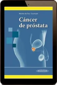 Descargar «Cancer de Prostata» de «Luis Montes de Oca» año 2022 + ePub