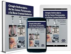 Libro Cirugia Endoscopica de Los Senos paranasales y la Base Craneal anterior PDF gratis + ePub