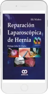Reparacion Laparoscopica de Hernia + 2 Dvds eBook 1 link resumen | R. Mishra 2022
