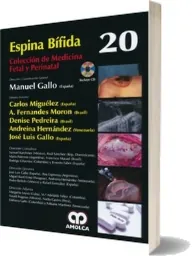 Descarga directa Espina Bifida + review y resumen 2022