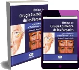 «Tecnicas de Cirugia Cosmetica de Los Parpados» eBook | Joseph a. Mauriello | Descargar PDF 2022