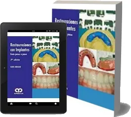 Restauraciones Con Implantes leer online Google Drive