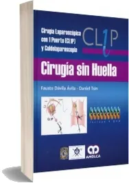 Descarga «Cirugia sin Huella. Cirugia Laparoscopica Con 1 Puerto y Culdolaparoscopia» de Fausto Davila en español completo sin registro 2022 Mega