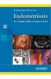PDF Endometriosis. Un Enfoque Medico- Quirurgico Global del autor Hector Bustos López