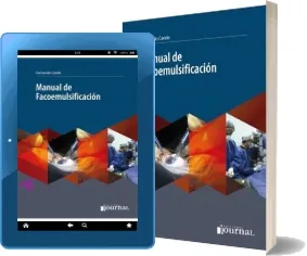 Descargar libro «Manual de Facoemulsificacion» para Kindle 2022 + resumen