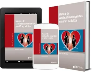 Libro gratis «Manual de Cardiopatias Congenitas en Niños y Adultos» PDF + ePub 2022 + resumen