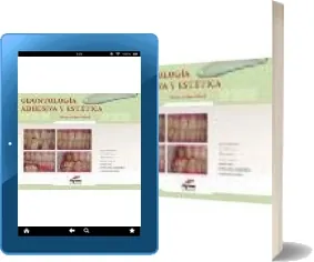 Libros completos para leer: Odontologia Adhesiva y Estetica de Rony Joubert Hued Google Books 2022 (Resubido)