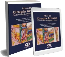 Bajar Atlas de Cirugia de Las Arterias. Fundamentos de Anatomia y Tecnica de Antonio Cavallaro (Amolca)