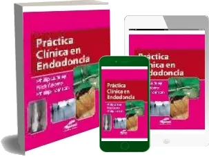 Practica Clinica en Endodoncia PDF | Phillip Lumley 2022 + eBook