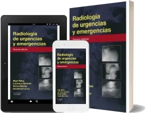 Radiologia de Urgencias y Emergencias, 3 actualizado en PDF + eBook