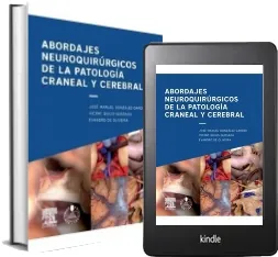 ePub Abordajes Neuroquirurgicos de la Patologia Craneal y Cerebral descargar online + resumen