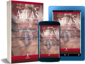 Descargar Atlas de Laparoscopia Ginecologica (Leonel Alfonso Pedraza González) en PDF 2022