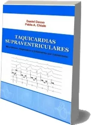 PDF libro Taquicardias Supraventriculares - Mecanismos Diagnostico y Tratamiento por Cateterismo + eBook