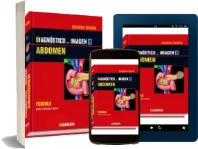 Google Drive gratis en PDF: Abdomen: Diagnostico por Imagen
