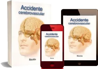Descargar «Accidente Cerebrovascular - Miniatlas» PDF completo 154 páginas 2022