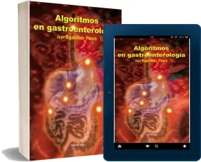 Descargar Algoritmos en Gastroenterologia completo 86 páginas + resumen