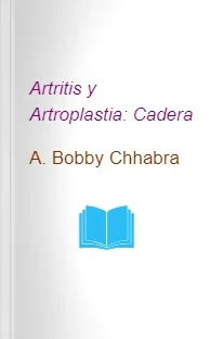 Artritis y Artroplastia: Cadera actualizado en PDF + resumen