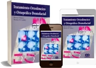 «Tratamiento Ortodoncico y Ortopedico Dentofacial» review + descarga directa PDF 2022 + eBook