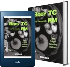 Bajar gratis Body tc Con Correlacion rm de Joseph k. t Libro completo Uptobox, MEGA, WeTransfer, Torrent, FileTransfer.io, Meocloud, MediaFire, Volafile, Dropbox 2022