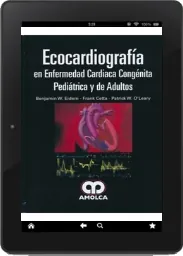 ePub + PDF MEGA Ecocardiografia en Enfermedad Cardiaca Congenita Pediatrica y de Adultos