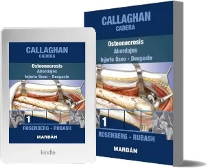 Callaghan Osteonecrosis- Injerto Oseo Descarga para móvil o tablet en PDF + resumen