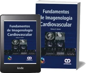 Libro «Fundamentos de Imagenologia Cardiovascular» PDF Gratis | N. Coster Google Drive