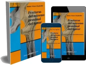 Descarga «Fracturas Del Extremo Proximal Del Femur. Estudio Anatomopatologico» para iPhone/iPad/Kindle 2022 Mega