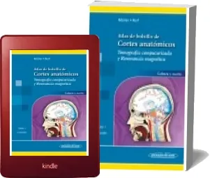 Libro Atlas de Bolsillo de Cortes Anatomicos. Tomografia Computarizada y Resonancia Magnetica. Tomo 1: Cabeza... online gratis + eBook