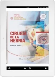eBook libro español MEGA Cirugia de la Hernia. Tecnicas en Cirugia General