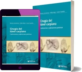 Descarga «Cirugia Del Tunel Carpiano. Controversias y Aplicaciones Practicas» de Mariano Socolovsky en español completo eBook 2022 Google Drive