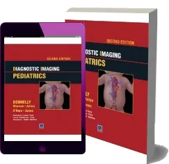 Descargar «Pediatria - Diagnostico por Imagen» idioma Español PDF 2022 + resumen