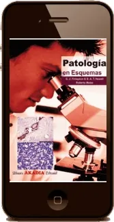 Libro completo Patologia en Esquemas + resumen para descargar