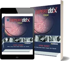 Descargar Expert Ddx: Torax PDF y eBook MEGA