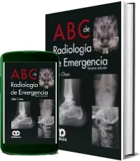 Abc de Radiologia de Emergencia libro completo gratis + eBook