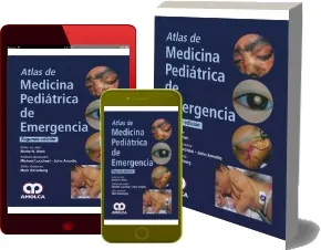 Bajar en PDF Atlas de Medicina Pediatrica de Emergencia o ePub gratis + resumen