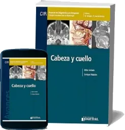 Libro gratis «Avances en Diagnostico por Imagenes 9: Cabeza y Cuello» PDF + ePub + resumen