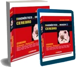 Libro «Cerebro- Diagnostico por Imagen» PDF Gratis | Anne g. Osborn 2022 + ePub